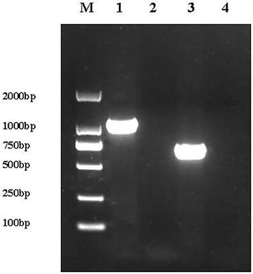 BasS/BasR Two-Component System Affects the Sensitivity of Escherichia coli to Plantaricin BM-1 by Regulating the Tricarboxylic Acid Cycle